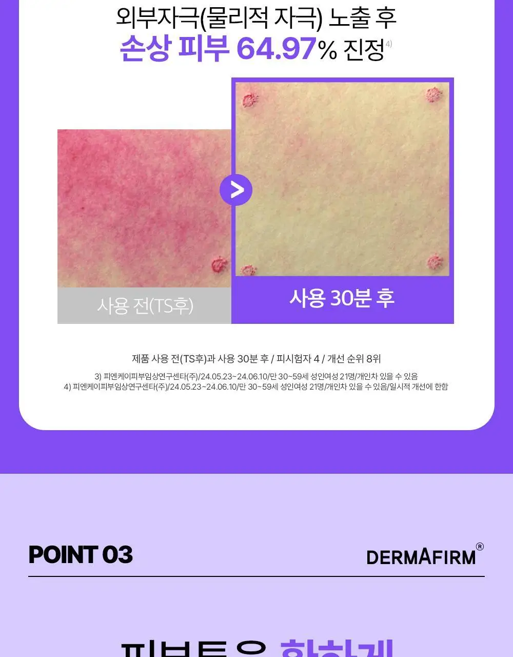 [흔적케어크림] 더마펌 수딩 리페어 토닝 크림 R4 50ml 기획 (+30ml) 상세페이지 24